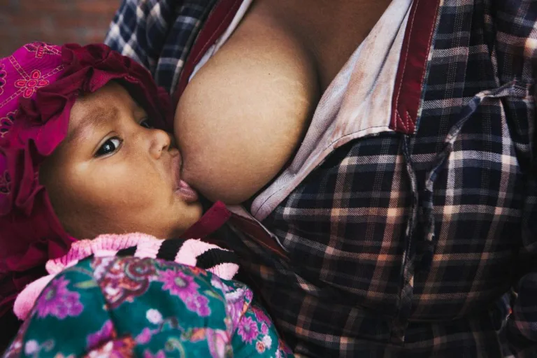 Can Breastfed Babies Get Yeast Infection?