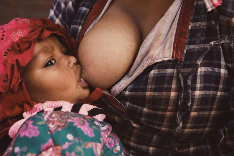 Is It Normal For Your Nipple To Fall Off While Breastfeeding?
